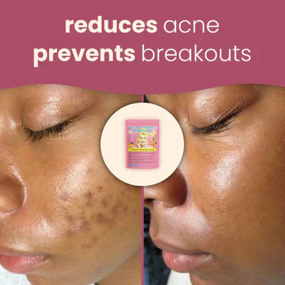 Brightening Turmeric & Kojic Pads
