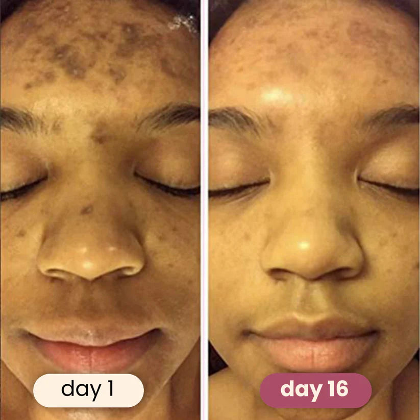 Brightening Turmeric & Kojic Pads