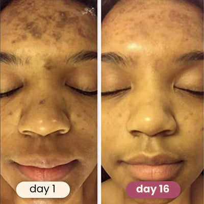 Brightening Turmeric & Kojic Pads