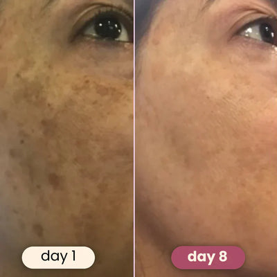 Brightening Turmeric & Kojic Pads