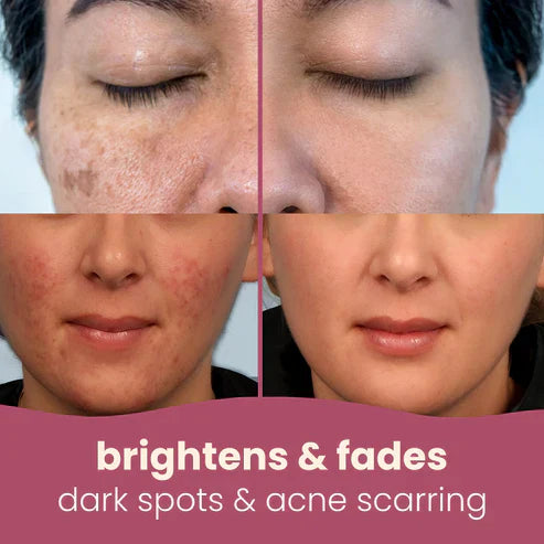 Brightening Turmeric & Kojic Pads